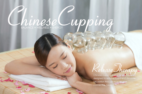 chinese-cupping-webSmall